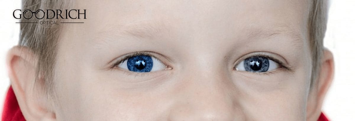 Heterochromia-GoodRich-Opticals.jpg?strip=all&lossy=1&fit=1200%2C410&ssl=1
