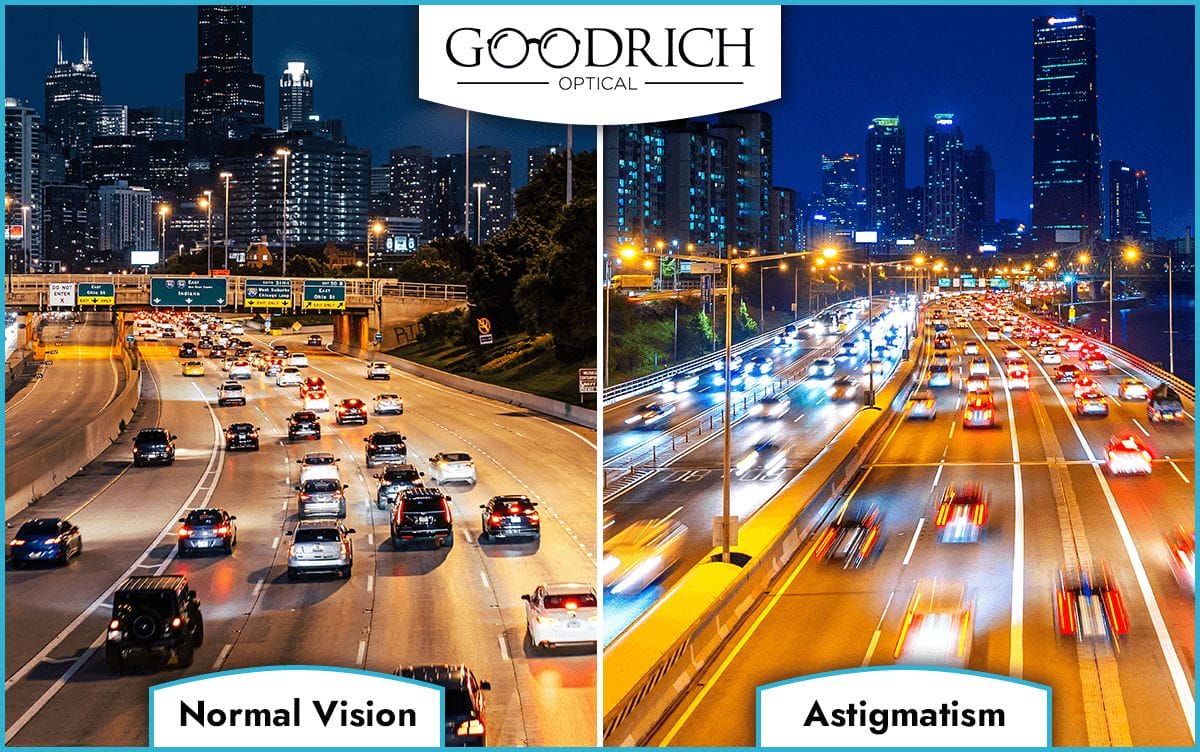 What is Astigmatism? Causes, Symptoms, Diagnosis and Prevention.